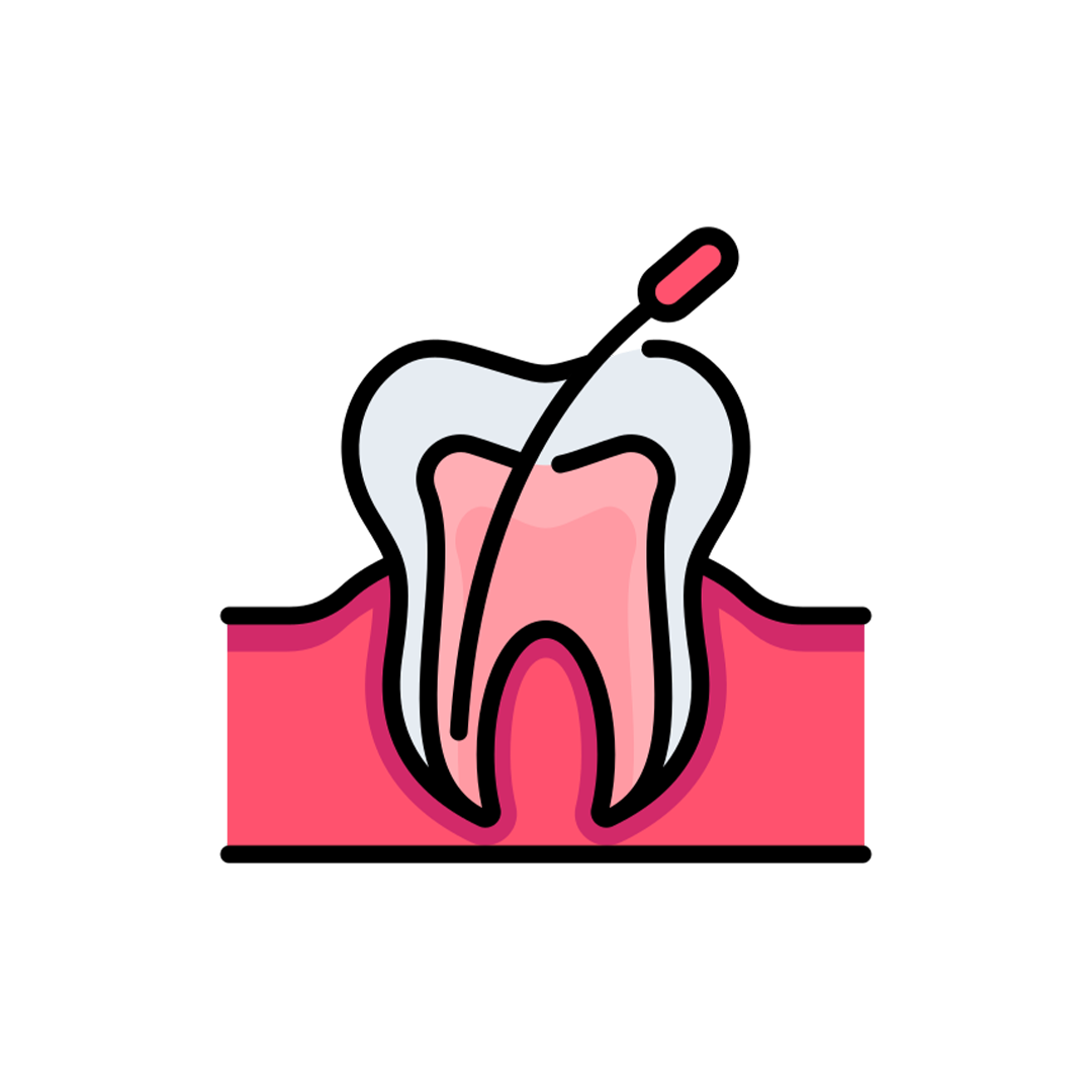 Root Canal & Endodontics
