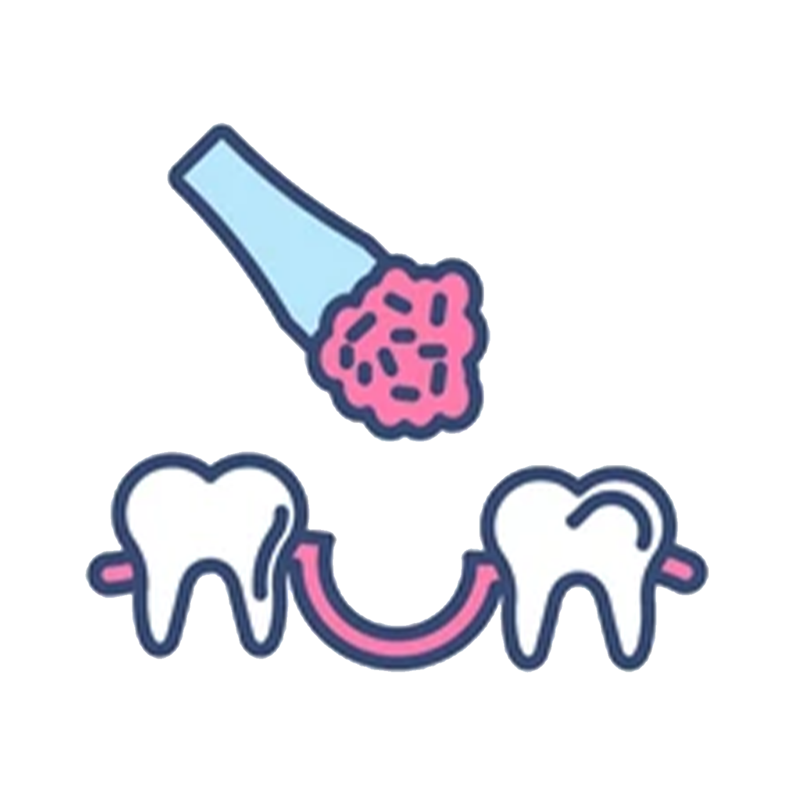 Bone Grafting & Sinus Lift Support