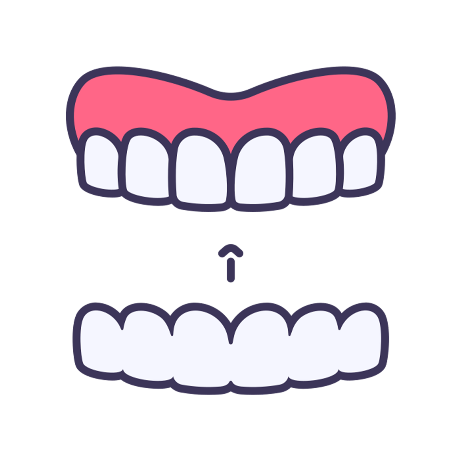 Invisible Braces Solutions