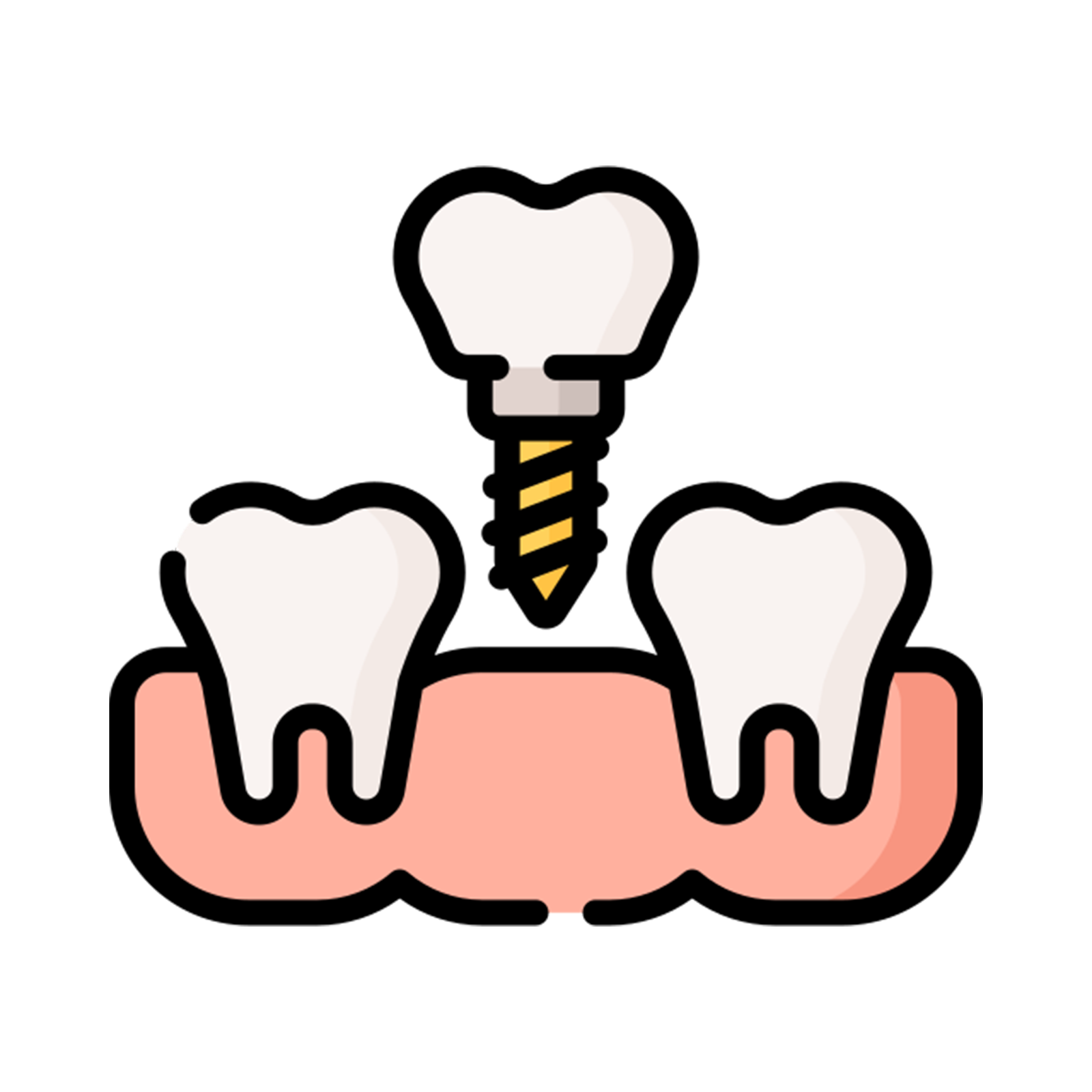Single & Multiple Tooth Implants